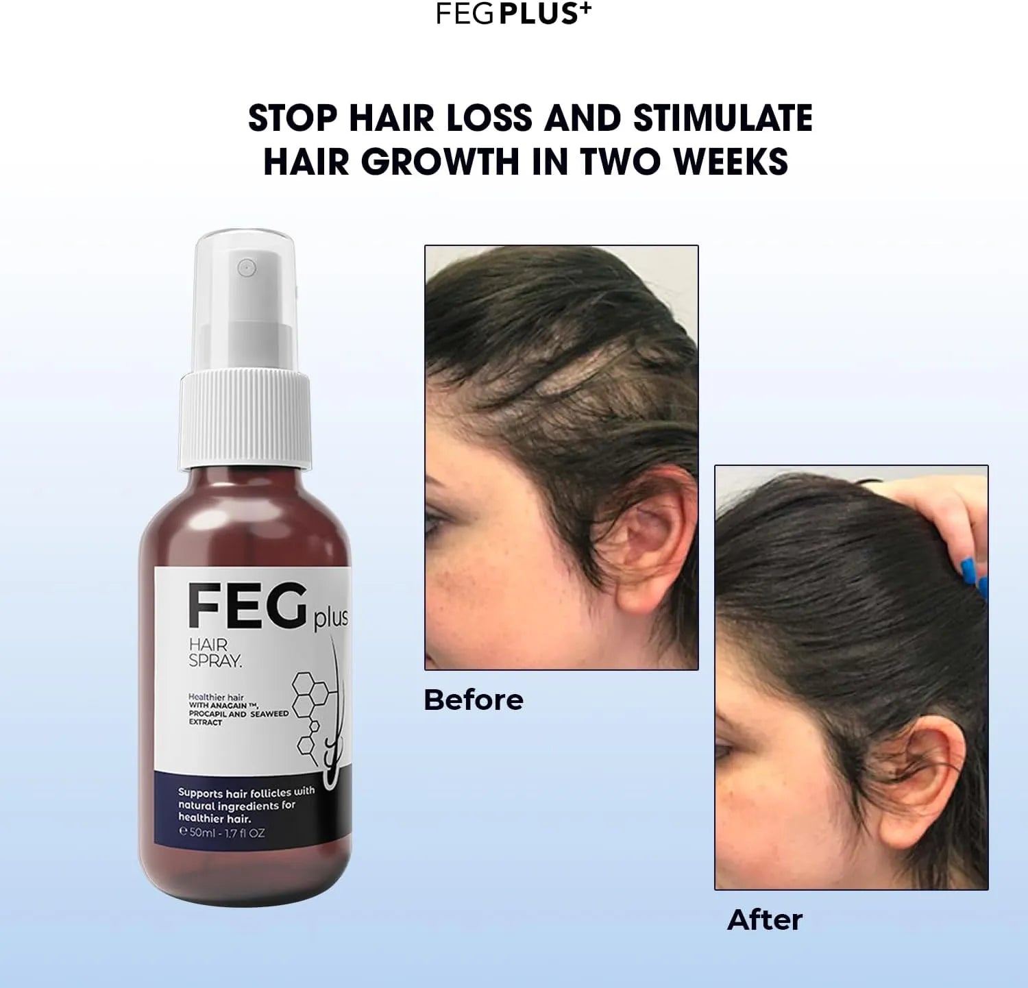 FEG Plus Hair Growth Serum – Advanced Hair Regrowth & Anti-Hair Fall Solution for Men & Women