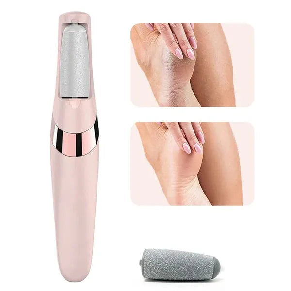 Electric Pedicure Foot File Callus Remover – Rechargeable Dead Skin Remover Tool for Smooth & Soft Feet
